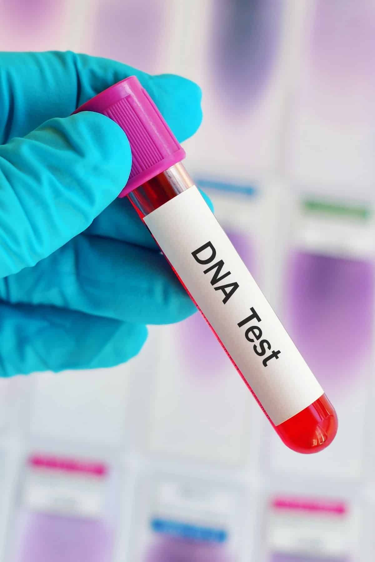 medical person holding a vial that says dna test.
